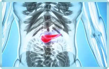 급성 췌장염 관리법